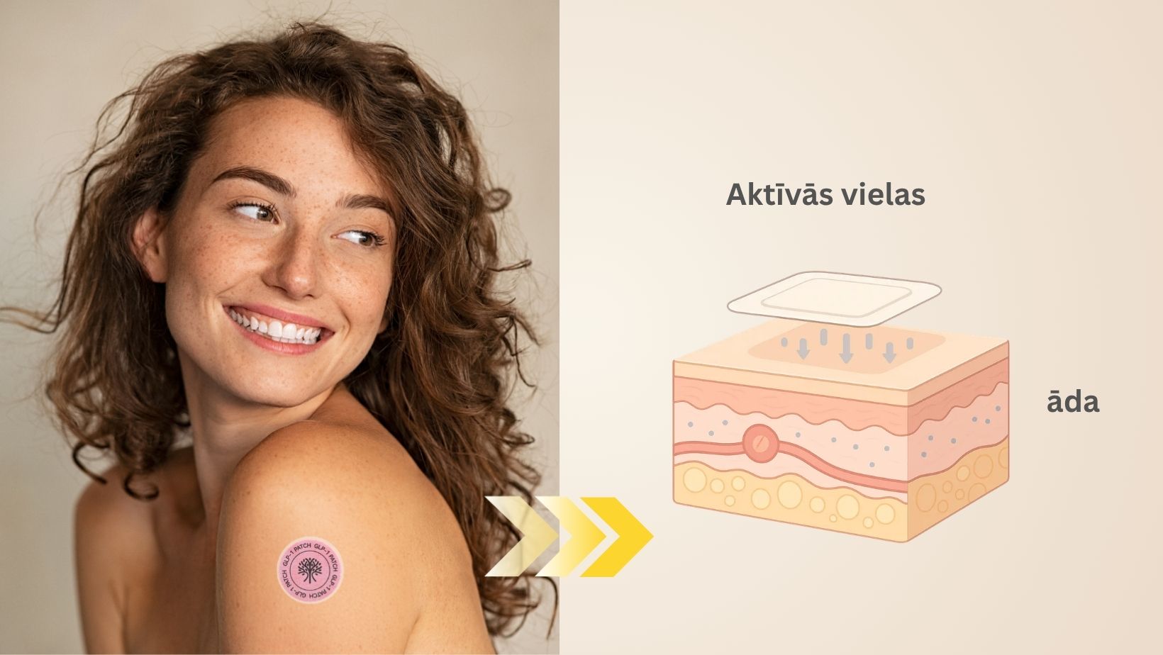 Transdermālie plāksteri ikdienas apetītes kontrolei