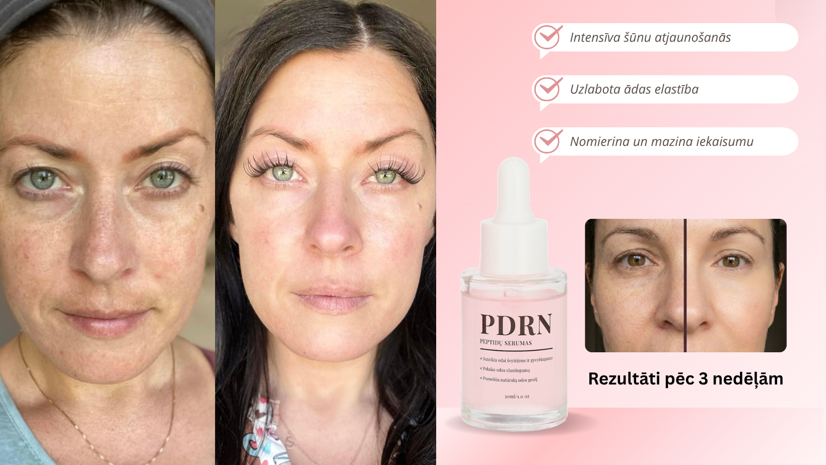 KERI PDRN peptīdu seruma rezultāts