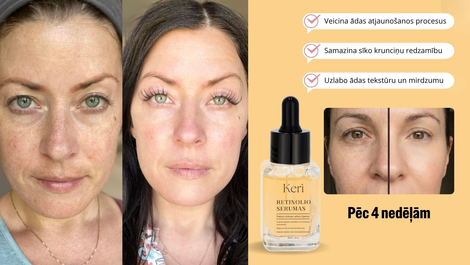 KERI nakts retinola seruma rezultāts